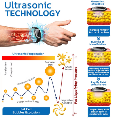 🌱🧑‍⚕️Ultrasonic Fat Blasting and Detoxing Wristband(🔥LAST DAY 70% OFF)